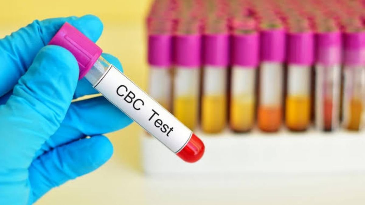 Reasons You Were Prescribed CBC Test - PNN Digital